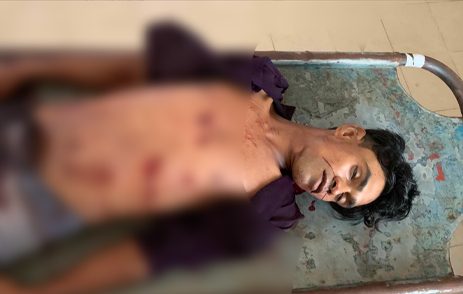 নগরীর কাজির বাজারে হোটেল কর্মচারী খু ন