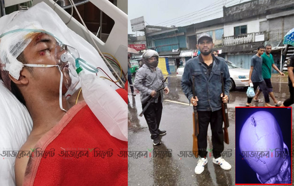 সিলেটে স্কুলছাত্র রাইয়ানকে ঢাকায় প্রেরণ : মাথায় বুলেট ছাত্রলীগ দুর্বৃত্তের ! 