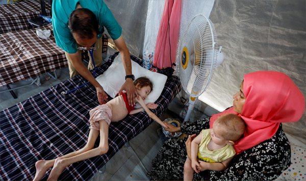 গাজায় ছড়িয়ে পড়ছে দুর্ভিক্ষ, অন্তত ৩৩ শিশুর মৃত্যু