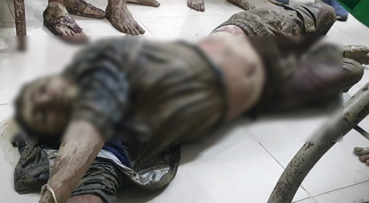 গ্রামবাসীর ধাওয়া খেয়ে ডাকাতের গুলিতে আহত সহকর্মী