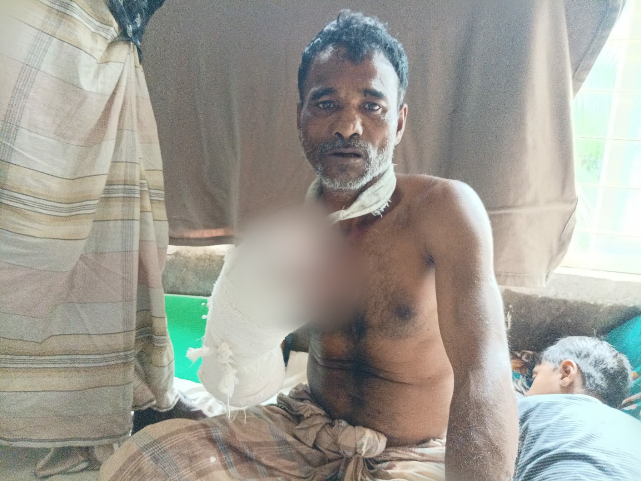 জৈন্তাপুর প্রতিবেশীদের হামলায় সুরুজ আলী'র ৩ আঙুল বিচ্ছিন্ন