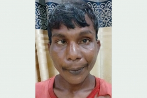 গোলাপগঞ্জে গুজবের শিকার বুদ্ধিপ্রতিবন্ধী 