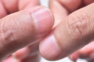 সুন্দর-পরিষ্কার ঝকঝকে নখ চান?