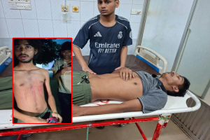 সিকৃবিতে ভেটেরিনারি অনুষদের জুনিয়রদের ওপর হামলা; আহত ২ জুনিয়র শিক্ষার্থী