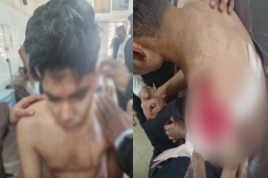 মেজরটিলায় সিনিয়র-জুনিয়র দ্বন্দ্বে স্কুলছাত্র ছুরিকাহত