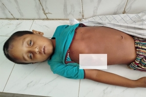 ধর্মপাশায় অটোরিকশার ধাক্কায় শিশুর মৃ ত্যু