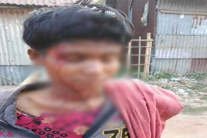মধ্যনগরে ভারসাম্যহীন নারীকে বেধড়ক মারধর