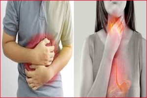 সহজেই দূর করুন এসিডিটি